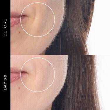 Renergie H.C.F. Triple Serum