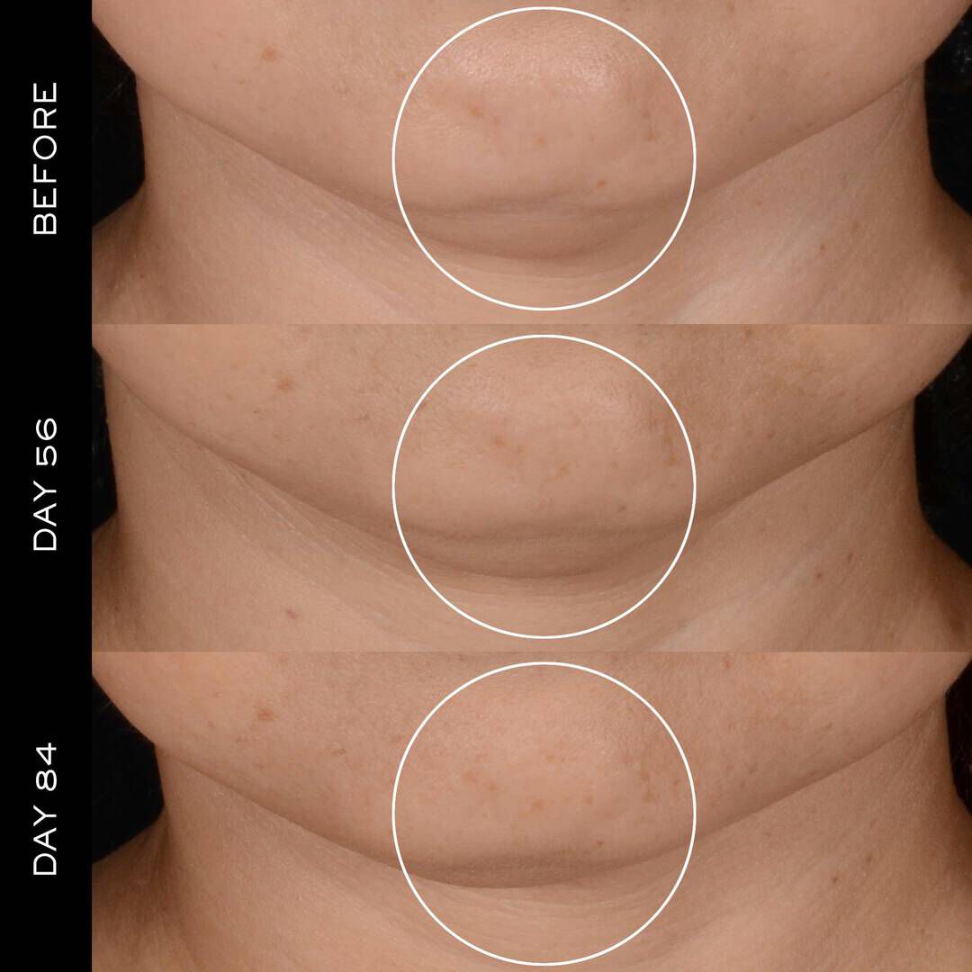 Renergie H.P.N. 300-Peptide Cream & Nahradni naplň